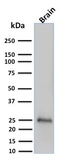 UCH-L1/PGP9.5 Antibody (UCHL1/775) - IHC-Prediluted Western Blot: UCH-L1/PGP9.5 Antibody (UCHL1/775) - IHC-Prediluted [NBP2-48315] -