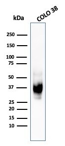 PMEL17/SILV Antibody (HMB45) - IHC-Prediluted Western Blot: PMEL17/SILV Antibody (HMB45) - IHC-Prediluted [NBP2-48316] -