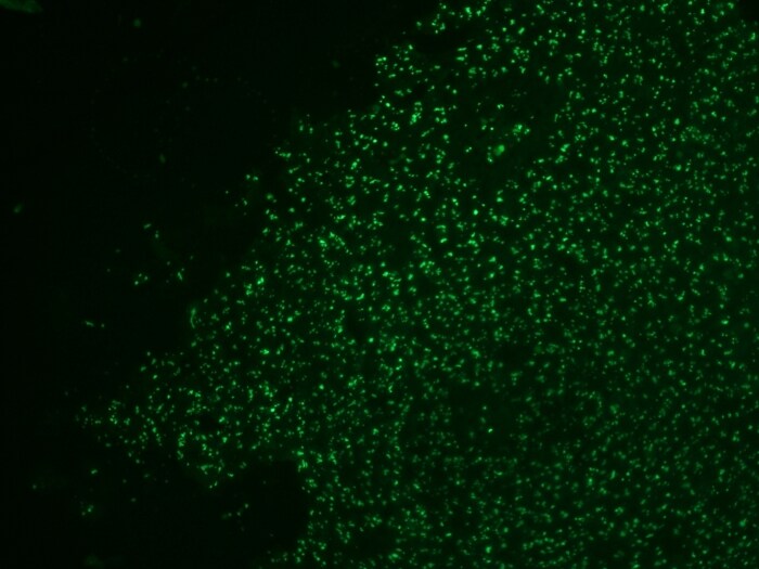Nucleolin Antibody (NCL/902) - IHC-Prediluted Immunocytochemistry/ Immunofluorescence: Nucleolin Antibody (NCL/902) - IHC-Prediluted [NBP2-48317] -