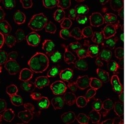 Nucleolin Antibody (NCL/902) - IHC-Prediluted Immunocytochemistry/ Immunofluorescence: Nucleolin Antibody (NCL/902) - IHC-Prediluted [NBP2-48317] -