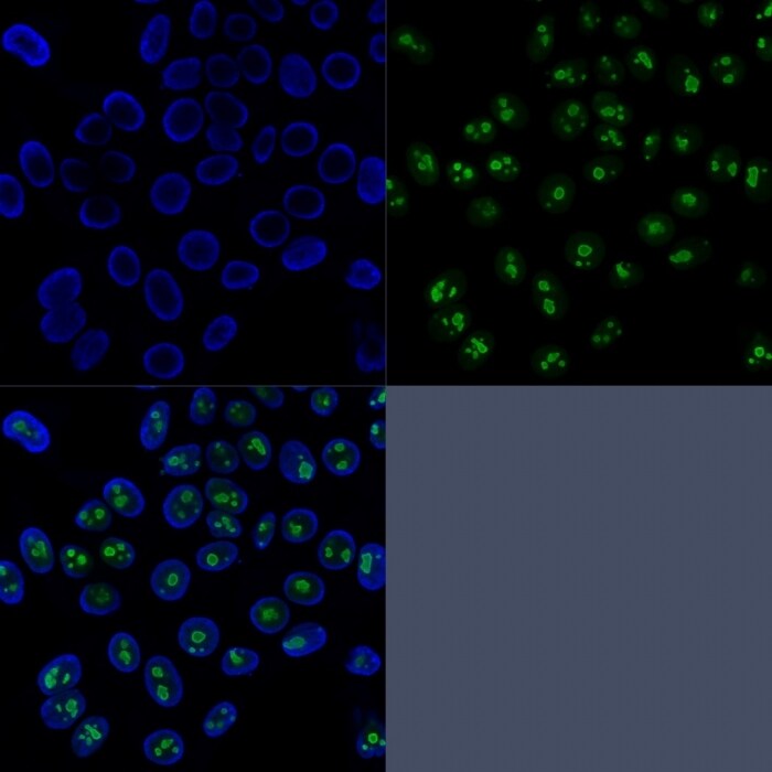 Nucleolin Antibody (SPM614) - IHC-Prediluted Immunocytochemistry/ Immunofluorescence: Nucleolin Antibody (SPM614) - IHC-Prediluted [NBP2-48318] -