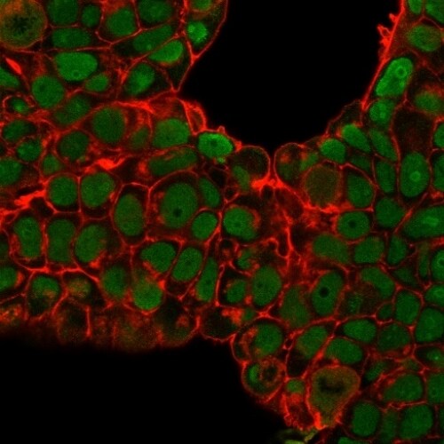 Nucleolin Antibody (SPM614) - IHC-Prediluted Immunocytochemistry/ Immunofluorescence: Nucleolin Antibody (SPM614) - IHC-Prediluted [NBP2-48318] -