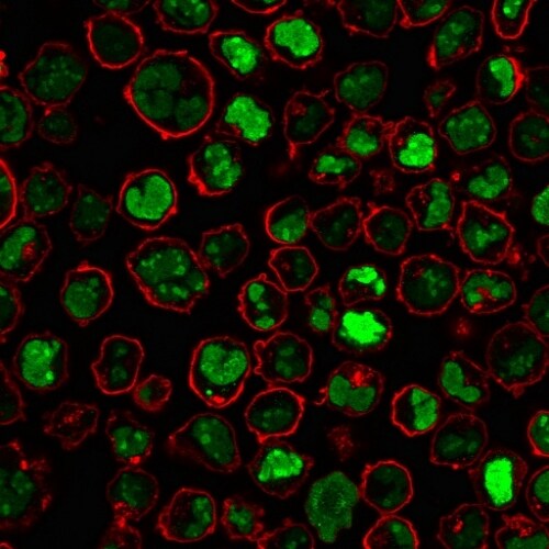 Nucleolin Antibody (364-5) - IHC-Prediluted Immunocytochemistry/ Immunofluorescence: Nucleolin Antibody (364-5) - IHC-Prediluted [NBP2-48319] -