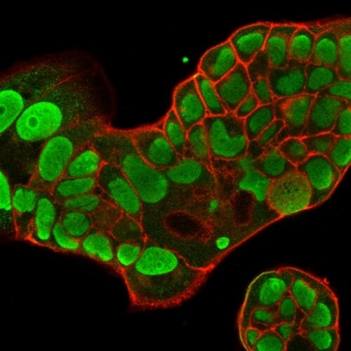 Nucleolin Antibody (364-5) - IHC-Prediluted Immunocytochemistry/ Immunofluorescence: Nucleolin Antibody (364-5) - IHC-Prediluted [NBP2-48319] -