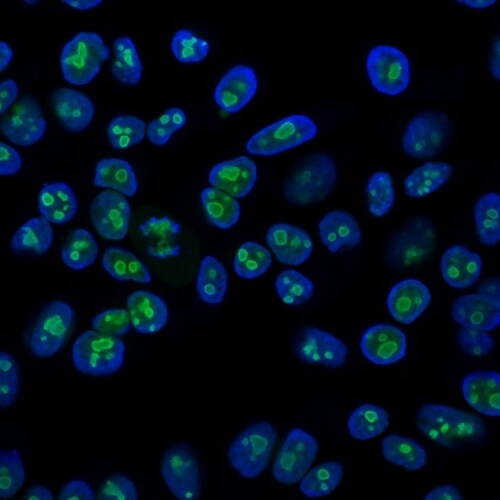 Nucleolin Antibody (364-5) - IHC-Prediluted Immunocytochemistry/ Immunofluorescence: Nucleolin Antibody (364-5) - IHC-Prediluted [NBP2-48319] -
