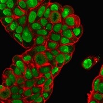 Nucleolin Antibody (364-5 + NCL/902) - IHC-Prediluted Immunocytochemistry/ Immunofluorescence: Nucleolin Antibody (364-5 + NCL/902) - IHC-Prediluted [NBP2-48320] -