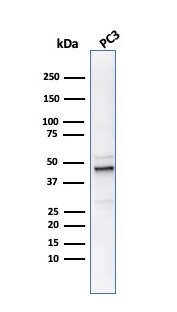 Ornithine Decarboxylase Antibody (ODC1/486) - IHC-Prediluted Western Blot: Ornithine Decarboxylase Antibody (ODC1/486) - IHC-Prediluted [NBP2-48321] -