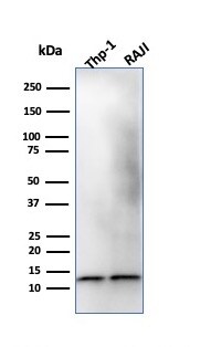 beta 2-Microglobulin Antibody (B2M/1118) - IHC-Prediluted Western Blot: beta 2-Microglobulin Antibody (B2M/1118) - IHC-Prediluted [NBP2-48327] -