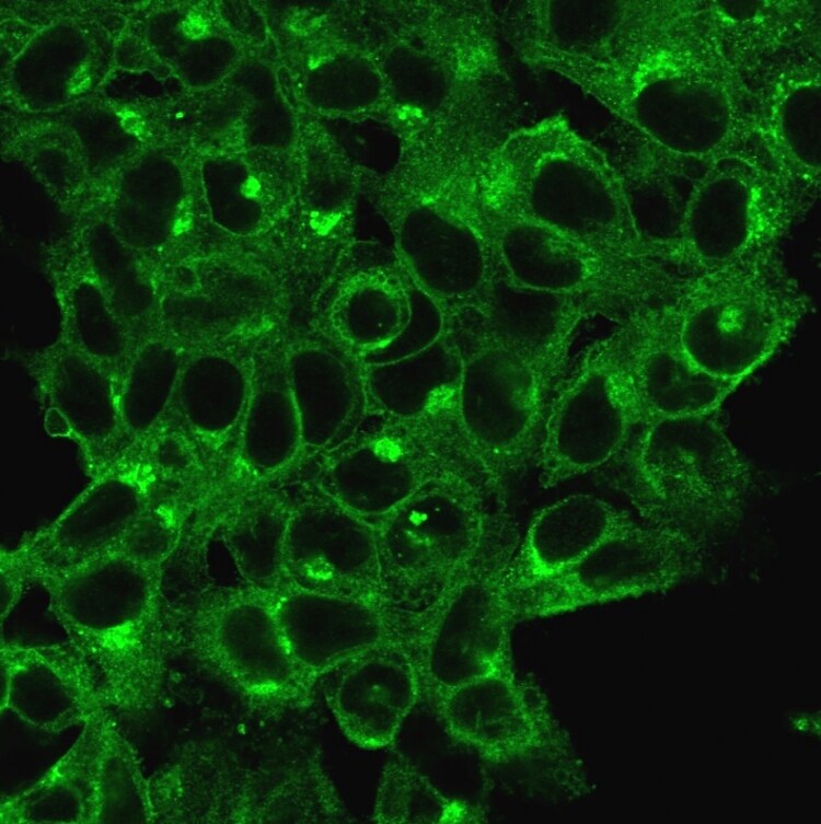 beta 2-Microglobulin Antibody (B2M/1118) - IHC-Prediluted Immunocytochemistry/ Immunofluorescence: beta 2-Microglobulin Antibody (B2M/1118) - IHC-Prediluted [NBP2-48327] -