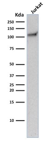 CD31/PECAM-1 Antibody (C31.10) - IHC-Prediluted Western Blot: CD31/PECAM-1 Antibody (C31.10) - IHC-Prediluted [NBP2-48330] -
