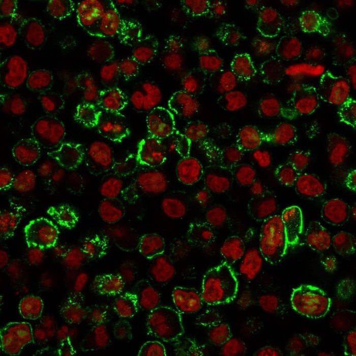 CD20 Antibody (IGEL/773) - IHC-Prediluted Immunocytochemistry/ Immunofluorescence: CD20 Antibody (IGEL/773) - IHC-Prediluted [NBP2-48335] -