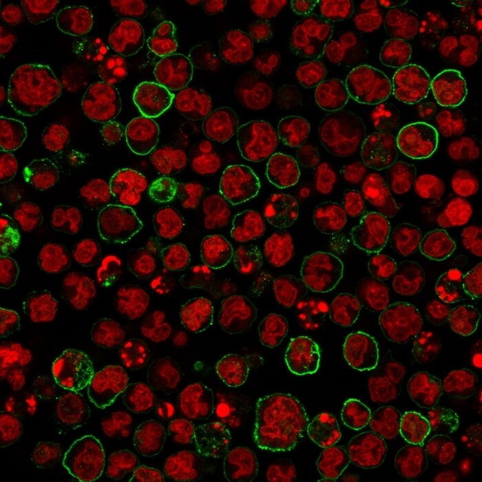 CD20 Antibody (SPM618) - IHC-Prediluted Immunocytochemistry/ Immunofluorescence: CD20 Antibody (SPM618) - IHC-Prediluted [NBP2-48336] -