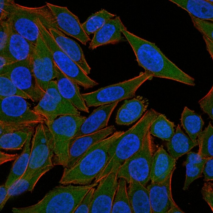Fascin Antibody (FSCN1/418) - IHC-Prediluted Immunocytochemistry/ Immunofluorescence: Fascin Antibody (FSCN1/418) - IHC-Prediluted [NBP2-48337] -