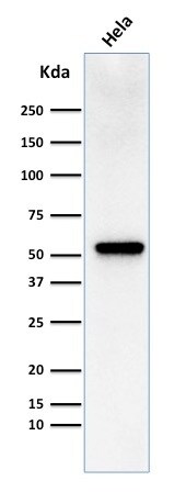 Fascin Antibody (FSCN1/418) - IHC-Prediluted Western Blot: Fascin Antibody (FSCN1/418) - IHC-Prediluted [NBP2-48337] -