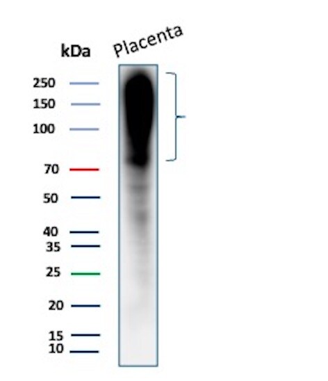 Fibronectin Antibody (568) - IHC-Prediluted Western Blot: Fibronectin Antibody (568) - IHC-Prediluted [NBP2-48338] -
