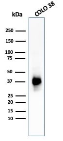 PMEL17/SILV Antibody (PMEL/783) - IHC-Prediluted Western Blot: PMEL17/SILV Antibody (PMEL/783) - IHC-Prediluted [NBP2-48341] -
