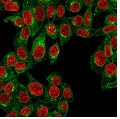 beta 2-Microglobulin Antibody (B2M/961) - IHC-Prediluted Immunocytochemistry/ Immunofluorescence: beta 2-Microglobulin Antibody (B2M/961) - IHC-Prediluted [NBP2-48345] -