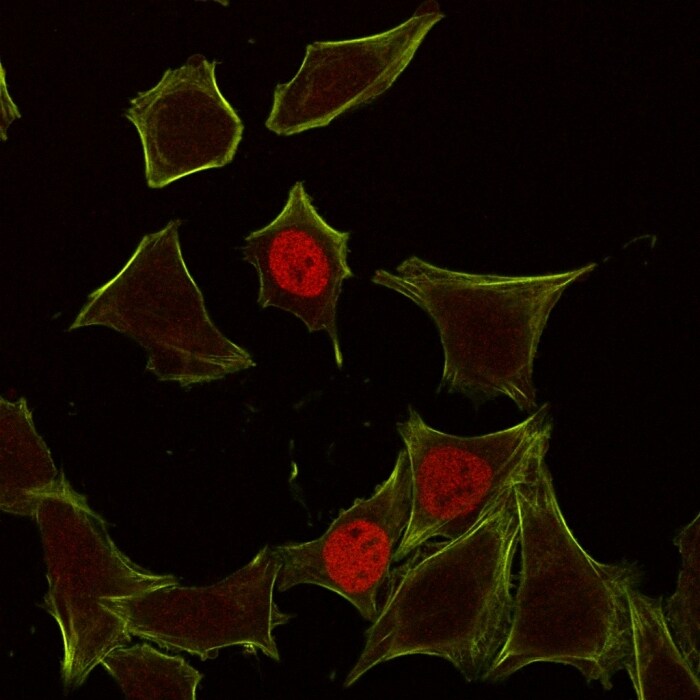 p21/CIP1/CDKN1A Antibody (CIP1/823) - IHC-Prediluted Immunocytochemistry/ Immunofluorescence: p21/CIP1/CDKN1A Antibody (CIP1/823) - IHC-Prediluted [NBP2-48371] -