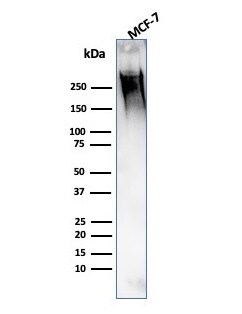 MUC1 Antibody (139H2) - IHC-Prediluted Western Blot: MUC1 Antibody (139H2) - IHC-Prediluted [NBP2-48378] -