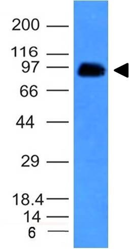 CD43/Sialophorin Antibody (SPN/839) - IHC-Prediluted Western Blot: CD43/Sialophorin Antibody (SPN/839) - IHC-Prediluted [NBP2-48379] -