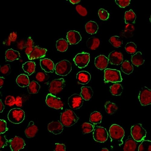 CD43/Sialophorin Antibody (SPN/1094) - IHC-Prediluted Immunocytochemistry/ Immunofluorescence: CD43/Sialophorin Antibody (SPN/1094) - IHC-Prediluted [NBP2-48394] -