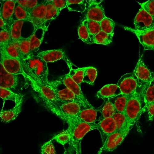 Glypican 3 Antibody (1G12) - IHC-Prediluted Immunocytochemistry/ Immunofluorescence: Glypican 3 Antibody (1G12) - IHC-Prediluted [NBP2-48396] -