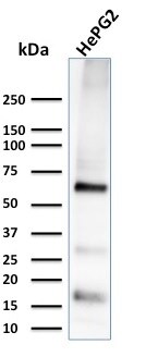Glypican 3 Antibody (1G12) - IHC-Prediluted Western Blot: Glypican 3 Antibody (1G12) - IHC-Prediluted [NBP2-48396] -