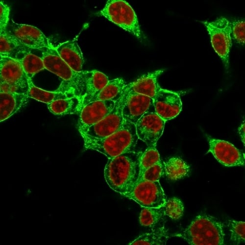 Glypican 3 Antibody (SPM595) - IHC-Prediluted Immunocytochemistry/ Immunofluorescence: Glypican 3 Antibody (SPM595) - IHC-Prediluted [NBP2-48397] -