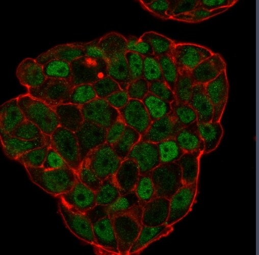 p27/Kip1 Antibody (KIP1/769) - IHC-Prediluted Immunocytochemistry/ Immunofluorescence: p27/Kip1 Antibody (KIP1/769) - IHC-Prediluted [NBP2-48399] -