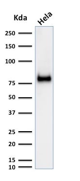CD44 Antibody (SPM521) - IHC-Prediluted Western Blot: CD44 Antibody (SPM521) - IHC-Prediluted [NBP2-48407] -