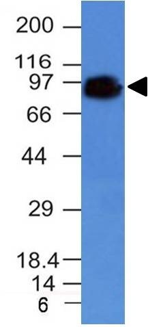 CD44 Antibody (HCAM/918) - IHC-Prediluted Western Blot: CD44 Antibody (HCAM/918) - IHC-Prediluted [NBP2-48408] -