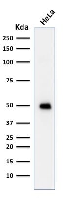 p53 Antibody (TRP/817) - IHC-Prediluted Western Blot: p53 Antibody (TRP/817) - IHC-Prediluted [NBP2-48410] -