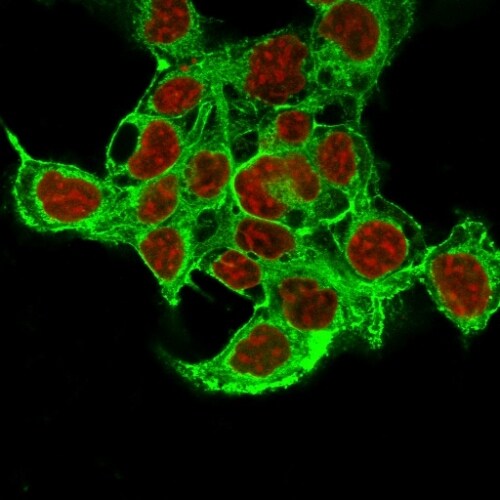 Glypican 3 Antibody (1G12 + GPC3/863) - IHC-Prediluted Immunocytochemistry/ Immunofluorescence: Glypican 3 Antibody (1G12 + GPC3/863) - IHC-Prediluted [NBP2-48418] -