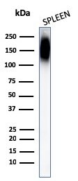 CD45RB Antibody (PTPRC/1147) - IHC-Prediluted Western Blot: CD45RB Antibody (PTPRC/1147) - IHC-Prediluted [NBP2-48463] -
