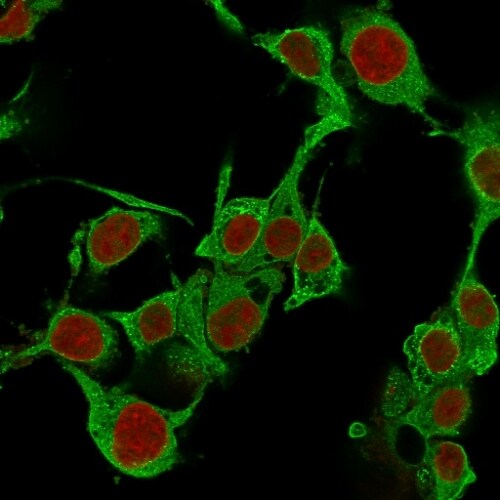 TNF-alpha Antibody (TNFA/1172) - IHC-Prediluted Immunocytochemistry/ Immunofluorescence: TNF-alpha Antibody (TNFA/1172) - IHC-Prediluted [NBP2-48470] -