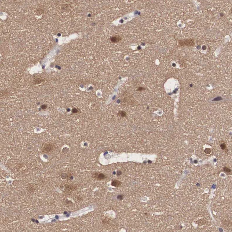 PDXP Antibody - BSA Free Immunohistochemistry: PDXP Antibody - BSA Free [NBP2-48487]