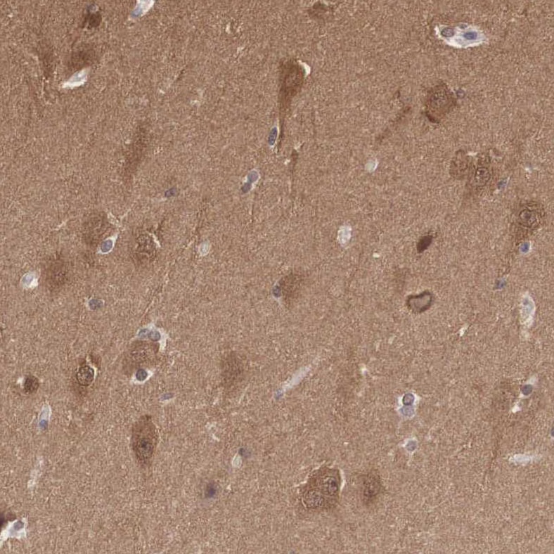 PDXP Antibody - BSA Free Immunohistochemistry: PDXP Antibody - BSA Free [NBP2-48487]