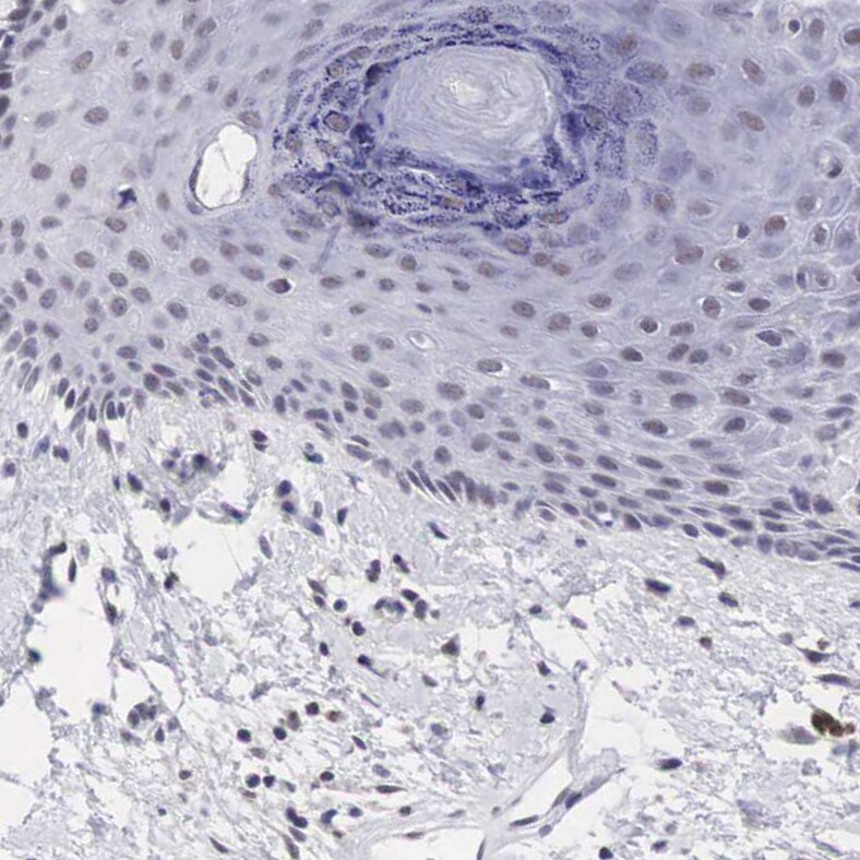 PDXP Antibody - BSA Free Immunohistochemistry: PDXP Antibody - BSA Free [NBP2-48487]