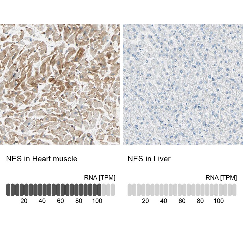 Nestin Antibody - BSA Free Immunohistochemistry-Paraffin: Nestin Antibody [NBP2-48504]