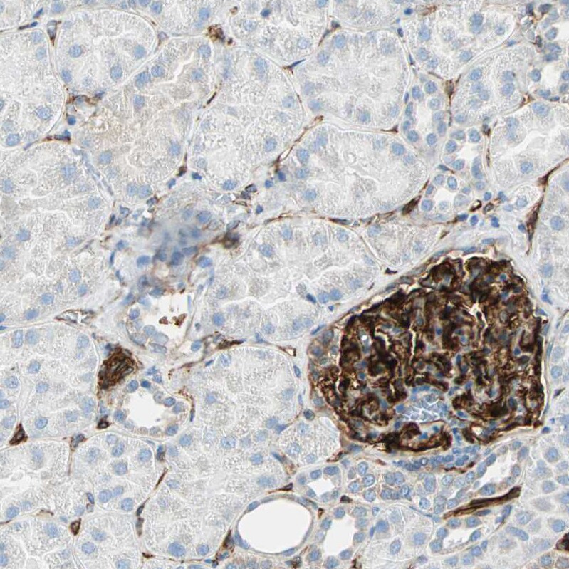 Nestin Antibody - BSA Free Immunohistochemistry-Paraffin: Nestin Antibody [NBP2-48504]