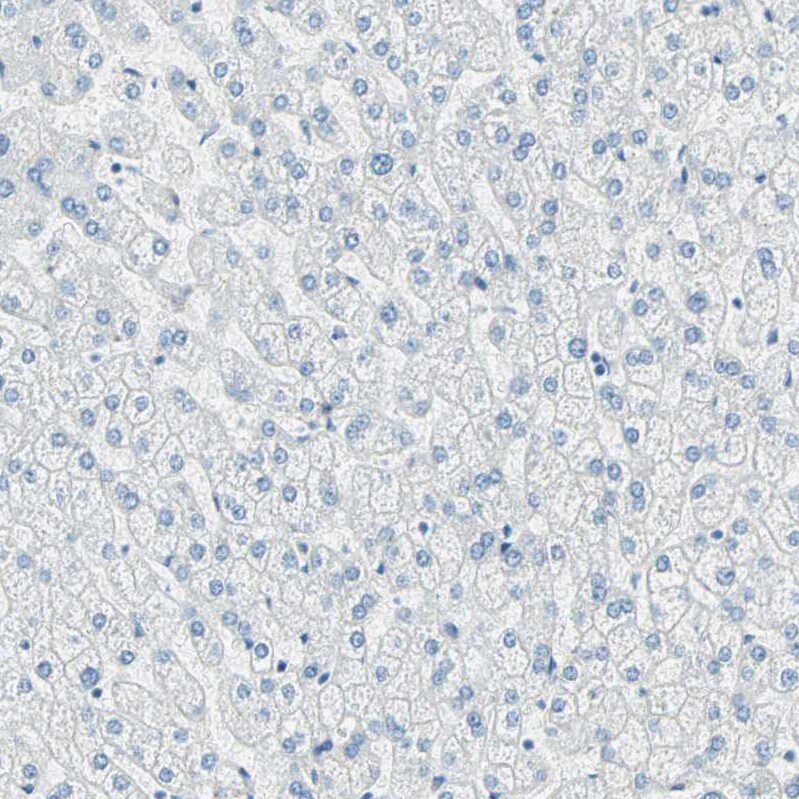 Nestin Antibody - BSA Free Immunohistochemistry-Paraffin: Nestin Antibody [NBP2-48504]