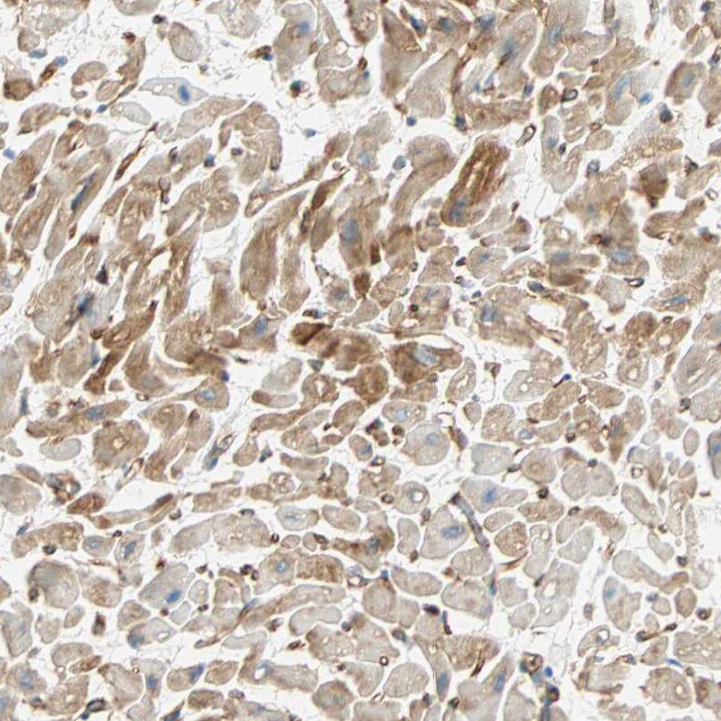 Nestin Antibody - BSA Free Immunohistochemistry-Paraffin: Nestin Antibody [NBP2-48504]