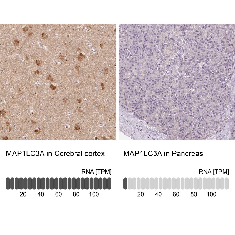 LC3A Antibody - BSA Free Immunohistochemistry-Paraffin: LC3A Antibody [NBP2-48512]