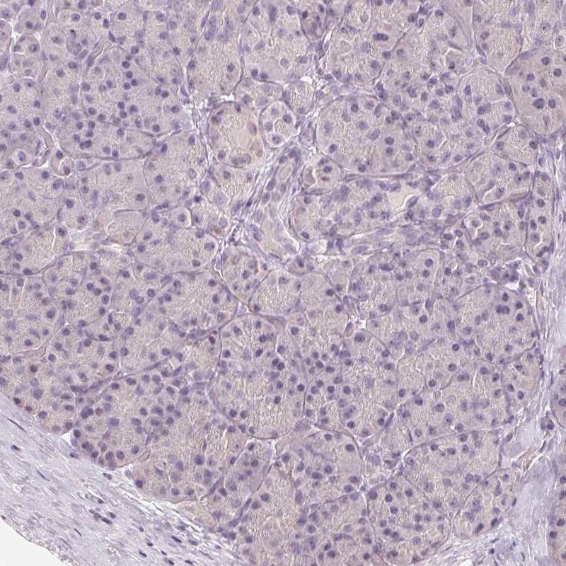 LC3A Antibody - BSA Free Immunohistochemistry-Paraffin: LC3A Antibody [NBP2-48512]