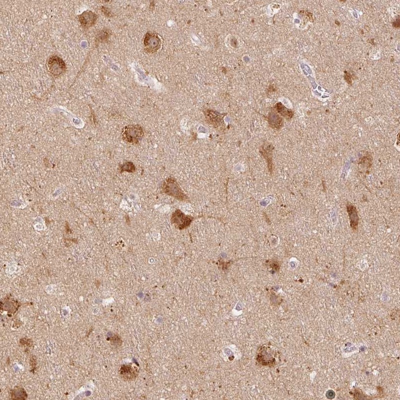 LC3A Antibody - BSA Free Immunohistochemistry-Paraffin: LC3A Antibody [NBP2-48512]