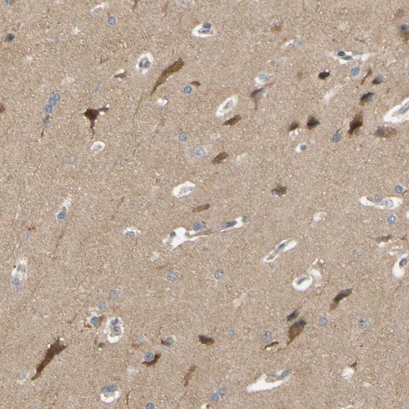 ALK/CD246 Antibody - BSA Free Immunohistochemistry-Paraffin: ALK/CD246 Antibody [NBP2-48518]