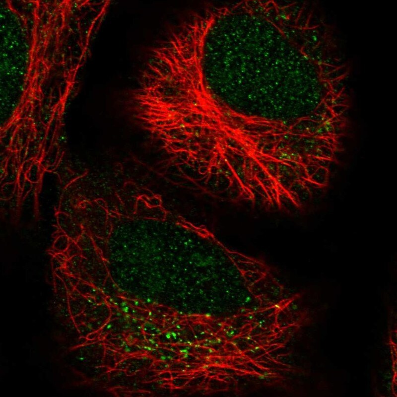 LRRK2 Antibody - BSA Free Immunocytochemistry/ Immunofluorescence: LRRK2 Antibody [NBP2-48524]