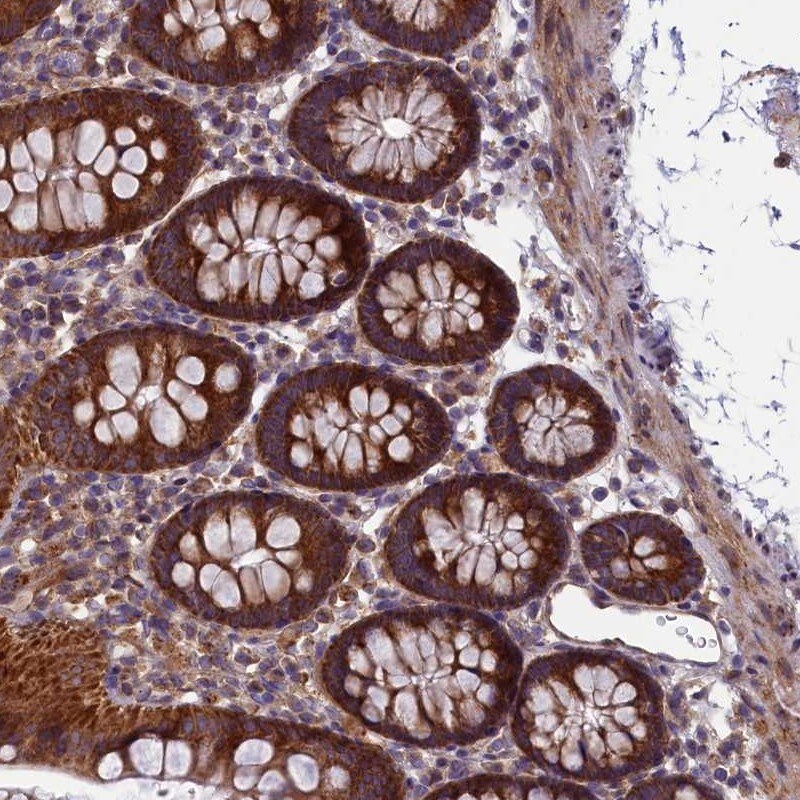ACAD8 Antibody - BSA Free Immunohistochemistry: ACAD8 Antibody - BSA Free [NBP2-48529]