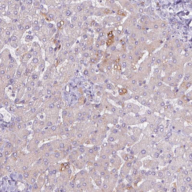 Perilipin-2/ADFP Antibody - BSA Free Immunohistochemistry-Paraffin: Perilipin-2/ADFP Antibody [NBP2-48532]