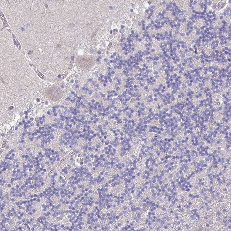 Perilipin-2/ADFP Antibody - BSA Free Immunohistochemistry-Paraffin: Perilipin-2/ADFP Antibody [NBP2-48532]